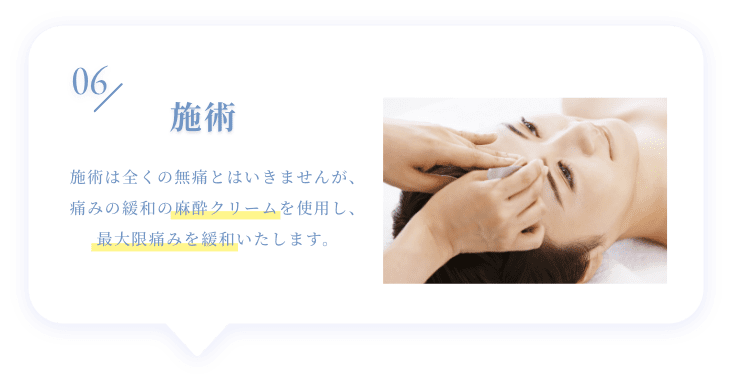 06 施術 施術は全くの無痛とはいきませんが、痛みの緩和の麻酔クリームを使用し、最大限痛みを緩和いたします。