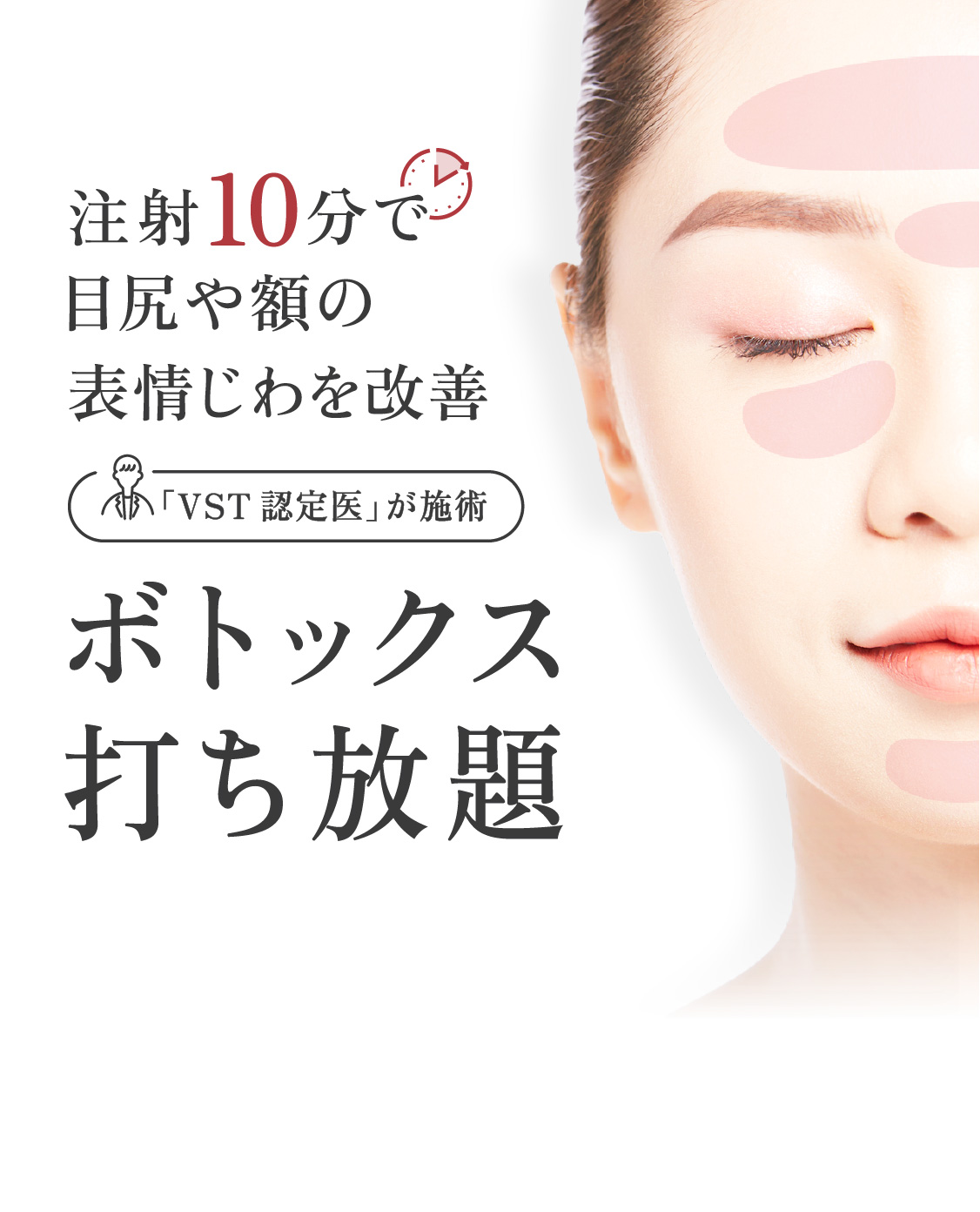 注射10分で目尻や額の表情じわを改善 ボトックス注射