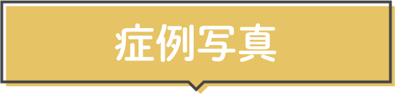 症例写真