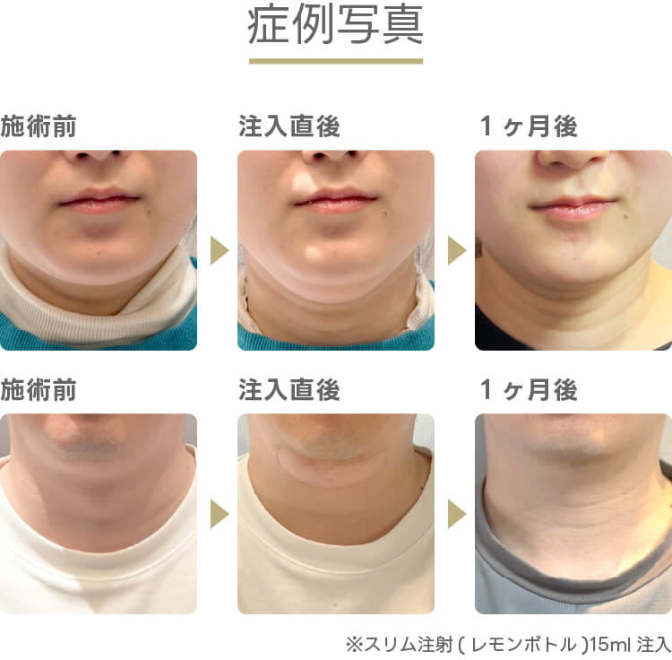 症例写真