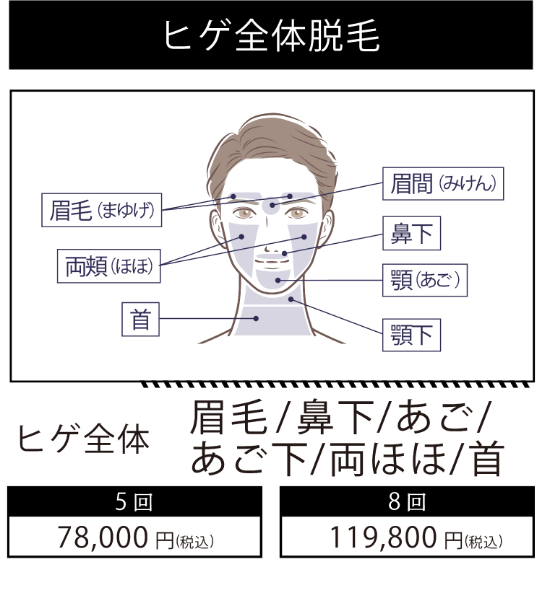 イデア皮膚科クリニック メンズ脱毛