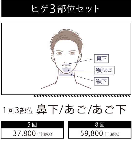 イデア皮膚科クリニック メンズ脱毛