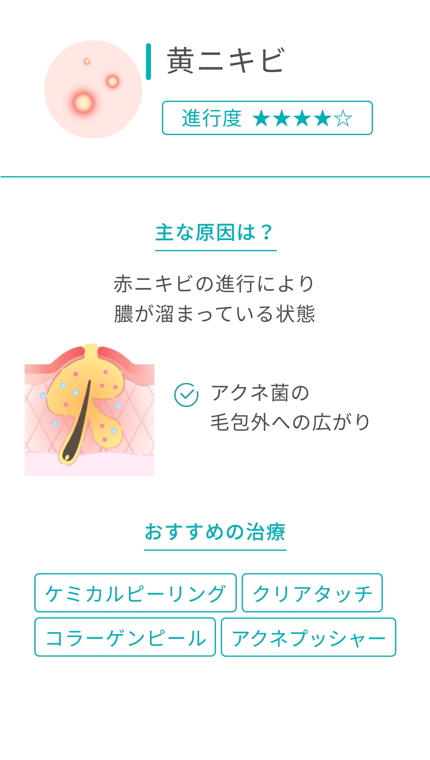 お肌のお悩み｜美肌治療ならイデア美容皮膚科クリニック【柏・船橋・錦糸町】